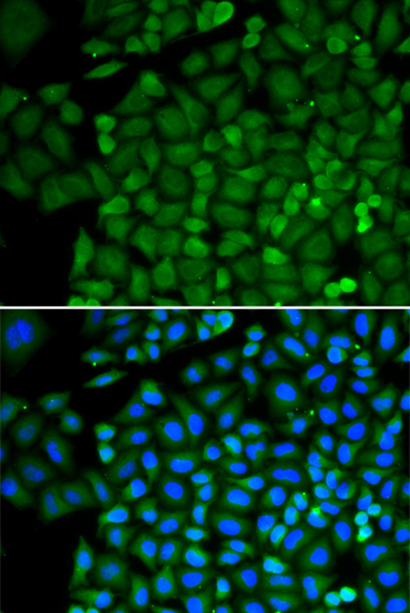 Hela cell; 4% Paraformaldehyde-fixed; Triton X-100 at room temperature for 20 min; Blocking buffer (normal goat serum, C-0005) at 37°C for 20 min; Antibody incubation with (SELENBP1) polyclonal Antibody, Unconjugated (bs-55195R) 1:100, 90 minutes at 37°C; followed by a conjugated Goat Anti-Rabbit IgG antibody at 37°C for 90 minutes, DAPI (blue, C02-04002) was used to stain the cell nuclei.