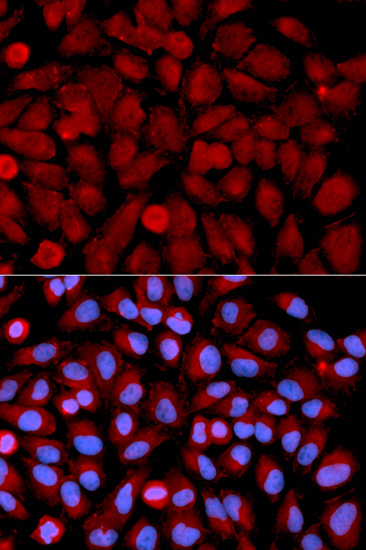 U2-OS cell; 4% Paraformaldehyde-fixed; Triton X-100 at room temperature for 20 min; Blocking buffer (normal goat serum, C-0005) at 37°C for 20 min; Antibody incubation with (MAPK9) polyclonal Antibody, Unconjugated (bs-55130R) 1:100, 90 minutes at 37°C; followed by a conjugated Goat Anti-Rabbit IgG antibody at 37°C for 90 minutes, DAPI (blue, C02-04002) was used to stain the cell nuclei.