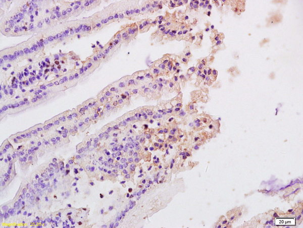 Formalin-fixed and paraffin embedded rat ileum labeled with Anti- MASP2 Polyclonal Antibody, Unconjugated (bs-1980R) at 1:200, followed by conjugation to the secondary antibody and DAB staining.