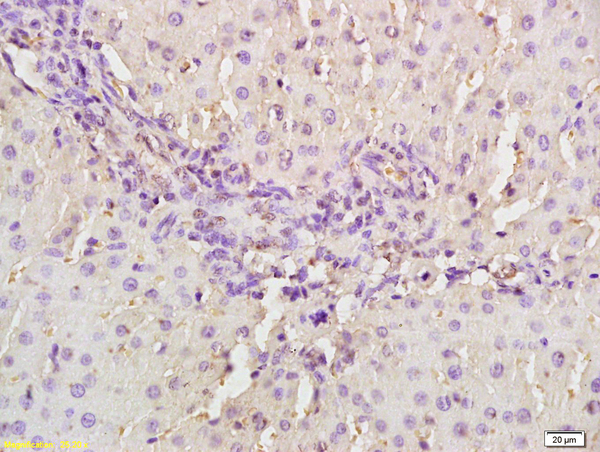 Formalin-fixed and paraffin embedded rat liver labeled with Anti- MASP2 Polyclonal Antibody, Unconjugated (bs-1980R) at 1:200, followed by conjugation to the secondary antibody and DAB staining.