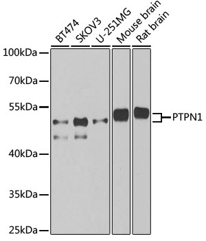 Lane 1: BT474 cell lysates; Lane 2: SKOV3 cell lysates; Lane 3: U251MG cell lysates; Lane 4: Mouse Brain lysates; Lane 5: Rat Brain lysates probed with PTPN1 Polyclonal Antibody, Unconjugated (bs-55182R) at 1:1000 dilution and 4˚C overnight incubation. Followed by conjugated secondary antibody incubation at 1:20000 for 60 min at 37˚C.