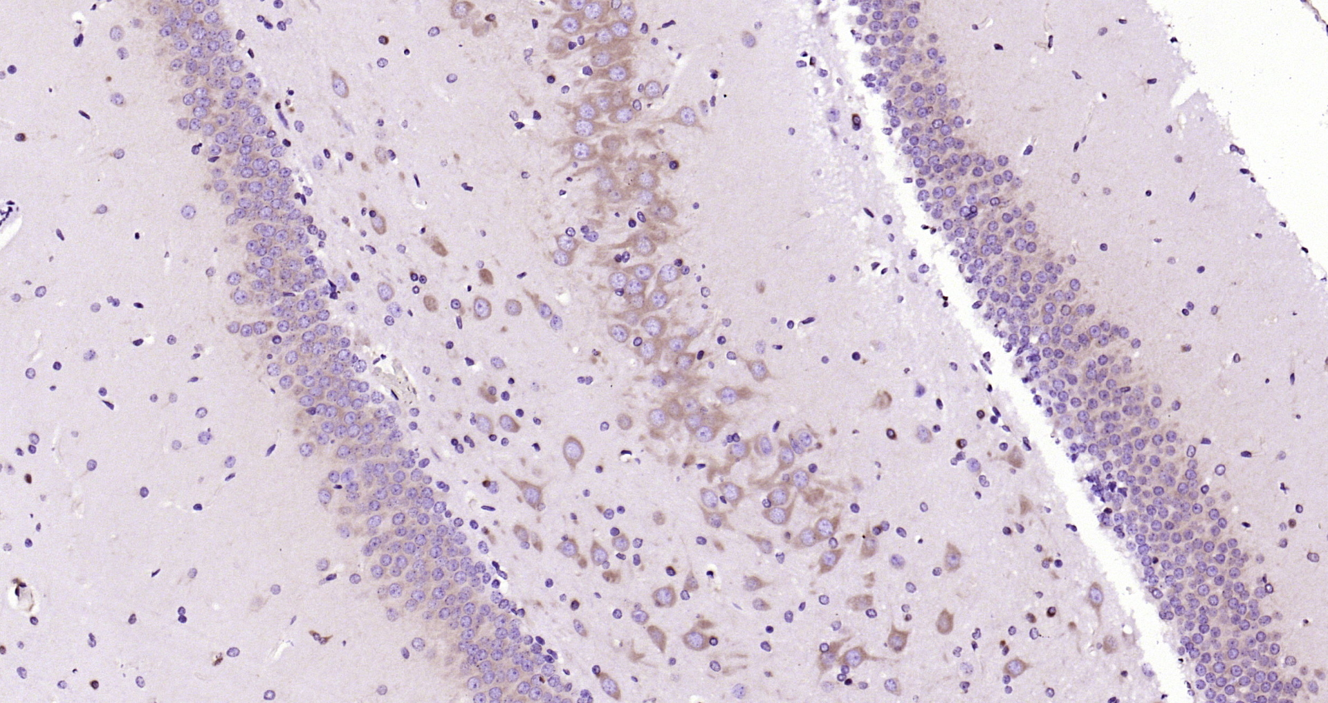 Paraformaldehyde-fixed, paraffin embedded Rat brain; Antigen retrieval by boiling in sodium citrate buffer (pH6.0) for 15min; Block endogenous peroxidase by 3% hydrogen peroxide for 20 minutes; Blocking buffer (normal goat serum) at 37°C for 30min; Antibody incubation with MEK2 (4C3) Monoclonal Antibody, Unconjugated (bsm-33216M) at 1:200 overnight at 4°C, DAB staining.