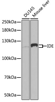 Lane 1: DU145 cell lysates; Lane 2: Mouse Liver cell lysates probed with IDE Polyclonal Antibody, Unconjugated (bs-55107R) at 1:1000 dilution and 4˚C overnight incubation. Followed by conjugated secondary antibody incubation at 1:20000 for 60 min at 37˚C.