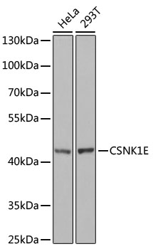 Lane 1: Hela cell lysates; Lane 2: 293T cell lysates probed with CSNK1E Polyclonal Antibody, Unconjugated (bs-55048R) at 1:1000 dilution and 4˚C overnight incubation. Followed by conjugated secondary antibody incubation at 1:20000 for 60 min at 37˚C.