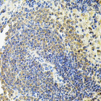 Paraformaldehyde-fixed, paraffin embedded Rat spleen; Antigen retrieval by boiling in sodium citrate buffer (pH6.0) for 15min; Block endogenous peroxidase by 3% hydrogen peroxide for 20 minutes; Blocking buffer (normal goat serum) at 37°C for 30min; Antibody incubation with RALBP1 Polyclonal Antibody, Unconjugated (bs-55186R) at 1:100 overnight at 4°C, DAB staining.