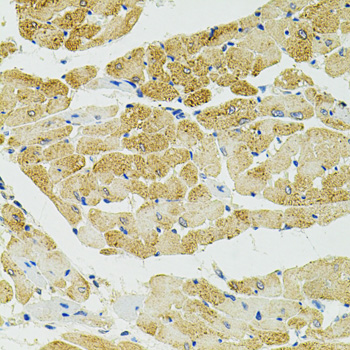 Paraformaldehyde-fixed, paraffin embedded Rat heart; Antigen retrieval by boiling in sodium citrate buffer (pH6.0) for 15min; Block endogenous peroxidase by 3% hydrogen peroxide for 20 minutes; Blocking buffer (normal goat serum) at 37°C for 30min; Antibody incubation with RALBP1 Polyclonal Antibody, Unconjugated (bs-55186R) at 1:100 overnight at 4°C, DAB staining.