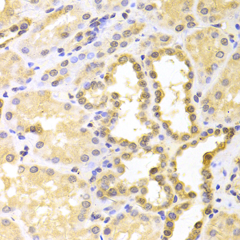 Paraformaldehyde-fixed, paraffin embedded Human kidney; Antigen retrieval by boiling in sodium citrate buffer (pH6.0) for 15min; Block endogenous peroxidase by 3% hydrogen peroxide for 20 minutes; Blocking buffer (normal goat serum) at 37°C for 30min; Antibody incubation with S100A11 Polyclonal Antibody, Unconjugated (bs-55189R) at 1:100 overnight at 4°C, DAB staining.