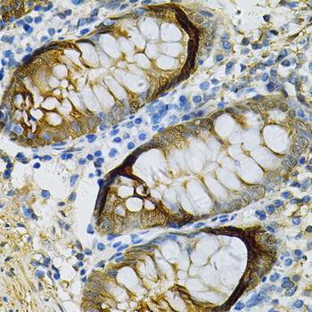 Paraformaldehyde-fixed, paraffin embedded Human colon; Antigen retrieval by boiling in sodium citrate buffer (pH6.0) for 15min; Block endogenous peroxidase by 3% hydrogen peroxide for 20 minutes; Blocking buffer (normal goat serum) at 37°C for 30min; Antibody incubation with SELENBP1 Polyclonal Antibody, Unconjugated (bs-55195R) at 1:100 overnight at 4°C, DAB staining.
