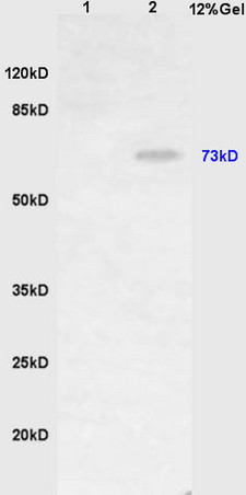 L1 mouse stomach lysates L2 mouse liver lysates probed with Anti HDC Polyclonal Antibody, Unconjugated (bs-1054R) at 1:200 in 4˚C. Followed by conjugation to secondary antibody (bs-0295G-HRP) at 1:3000 90min in 37˚C. Predicted band 73kD. Observed band size: 73kD