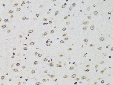 Paraformaldehyde-fixed, paraffin embedded Mouse brain; Antigen retrieval by boiling in sodium citrate buffer (pH6.0) for 15min; Block endogenous peroxidase by 3% hydrogen peroxide for 20 minutes; Blocking buffer (normal goat serum) at 37°C for 30min; Antibody incubation with TMPO Polyclonal Antibody, Unconjugated (bs-55216R) at 1:100 overnight at 4°C, DAB staining. Paraformaldehyde-fixed, paraffin embedded Mouse brain; Antigen retrieval by boiling in sodium citrate buffer (pH6.0) for 15min; Block endogenous peroxidase by 3% hydrogen peroxide for 20 minutes; Blocking buffer (normal goat serum) at 37°C for 30min; Antibody incubation with TMPO Polyclonal Antibody, Unconjugated (bs-55216R) at 1:100 overnight at 4°C, DAB staining.
