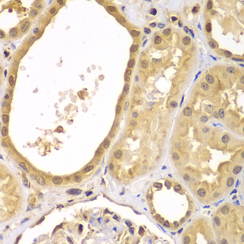 Paraformaldehyde-fixed, paraffin embedded Human kidney; Antigen retrieval by boiling in sodium citrate buffer (pH6.0) for 15min; Block endogenous peroxidase by 3% hydrogen peroxide for 20 minutes; Blocking buffer (normal goat serum) at 37°C for 30min; Antibody incubation with XIAP Polyclonal Antibody, Unconjugated (bs-55223R) at 1:100 overnight at 4°C, DAB staining.