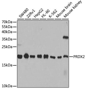 Lane 1: SW480 cell lysates; Lane 2: 22Rv1 cell lysates; Lane 3: HepG2 cell lysates; Lane 4: HL-60 cell lysates; Lane 5: K562 cell lysates; Lane 6: Mouse brain lysates; Lane 7: Mouse kidney lysates probed with PRDX2 Polyclonal Antibody, Unconjugated (bs-55172R) at 1:1000 dilution and 4˚C overnight incubation. Followed by conjugated secondary antibody incubation at 1:20000 for 60 min at 37˚C.
