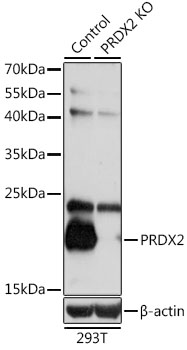 Lane 1: 293T cell lysates; Lane 2: PRDX2 knockout (KO) 293T cell lysates probed with PRDX2 Polyclonal Antibody, Unconjugated (bs-55172R) at 1:1000 dilution and 4˚C overnight incubation. Followed by conjugated secondary antibody incubation at 1:20000 for 60 min at 37˚C.