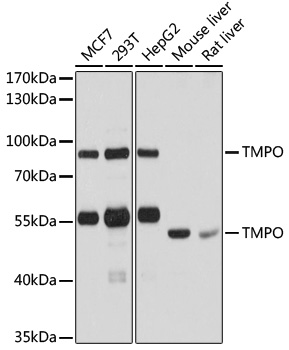 Lane 1: MCF-7 cell lysates; Lane 2: 293T cell lysates; Lane 3: HepG2 cell lysates; Lane 4: Mouse Liver lysates; Lane 5: Rat Liver lysates probed with TMPO Polyclonal Antibody, Unconjugated (bs-55216R) at 1:1000 dilution and 4˚C overnight incubation. Followed by conjugated secondary antibody incubation at 1:20000 for 60 min at 37˚C. Lane 1: MCF-7 cell lysates; Lane 2: 293T cell lysates; Lane 3: HepG2 cell lysates; Lane 4: Mouse Liver lysates; Lane 5: Rat Liver lysates probed with TMPO Polyclonal Antibody, Unconjugated (bs-55216R) at 1:1000 dilution and 4˚C overnight incubation. Followed by conjugated secondary antibody incubation at 1:20000 for 60 min at 37˚C.