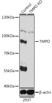 Lane 1: 293T cell lysates; Lane 2: TMPO knockout (KO) 293T cell lysates probed with TMPO Polyclonal Antibody, Unconjugated (bs-55216R) at 1:1000 dilution and 4˚C overnight incubation. Followed by conjugated secondary antibody incubation at 1:20000 for 60 min at 37˚C. Lane 1: 293T cell lysates; Lane 2: TMPO knockout (KO) 293T cell lysates probed with TMPO Polyclonal Antibody, Unconjugated (bs-55216R) at 1:1000 dilution and 4˚C overnight incubation. Followed by conjugated secondary antibody incubation at 1:20000 for 60 min at 37˚C.