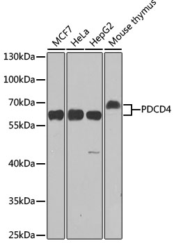 Lane 1: MCF-7 cell lysates; Lane 2: Hela cell lysates; Lane 3: HepG2 cell lysates; Lane 4: Mouse Thymus lysates probed with PDCD4 Polyclonal Antibody, Unconjugated (bs-55166R) at 1:1000 dilution and 4˚C overnight incubation. Followed by conjugated secondary antibody incubation at 1:20000 for 60 min at 37˚C.