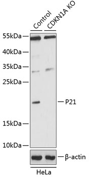 Lane 1: Hela cell lysates; Lane 2: P21 knockout (KO) HeLa cell lysates probed with P21 Polyclonal Antibody, Unconjugated (bs-55160R) at 1:1000 dilution and 4˚C overnight incubation. Followed by conjugated secondary antibody incubation at 1:20000 for 60 min at 37˚C.