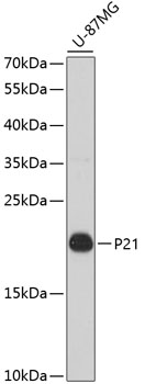 Lane 1: U87-MG cell lysates probed with P21 Polyclonal Antibody, Unconjugated (bs-55160R) at 1:1000 dilution and 4˚C overnight incubation. Followed by conjugated secondary antibody incubation at 1:20000 for 60 min at 37˚C.