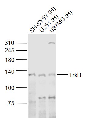 Lane 1: Human SH-SY5Y cell lysates; Lane 2: Human U251 cell lysates; Lane 3: Human U-87MG cell lysates probed with TrkB Polyclonal Antibody, Unconjugated (bs-0175R) at 1:1000 dilution and 4˚C overnight incubation. Followed by conjugated secondary antibody incubation at 1:20000 for 60 min at 37˚C.