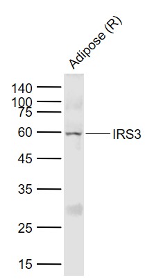 Lane 1: Rat adipose lysates probed with IRS-3 Polyclonal Antibody, Unconjugated (bs-0186R) at 1:1000 dilution and 4˚C overnight incubation. Followed by conjugated secondary antibody incubation at 1:20000 for 60 min at 37˚C.