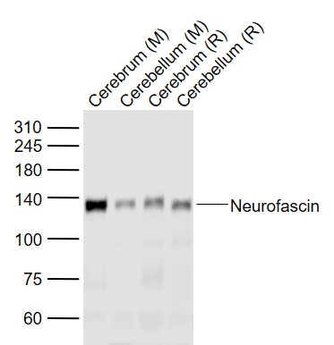 Lane 1: Mouse Cerebrum lysates; Lane 2: Mouse Cerebellum lysates; Lane 3: Rat Cerebrum lysates; Lane 4: Rat Cerebellum lysates probed with Neurofascin Polyclonal Antibody, Unconjugated (bs-0289R) at 1:1000 dilution and 4˚C overnight incubation. Followed by conjugated secondary antibody incubation at 1:20000 for 60 min at 37˚C.
