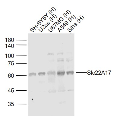 Lane 1: Human SH-SY5Y cell lysates; Lane 2: Human U-2OS cell lysates; Lane 3: Human U-87MG cell lysates; Lane 4: Human A549 cell lysates; Lane 5: Human Siha cell lysates probed with Slc22A17 Polyclonal Antibody, Unconjugated (bs-0444R) at 1:1000 dilution and 4˚C overnight incubation. Followed by conjugated secondary antibody incubation at 1:20000 for 60 min at 37˚C.