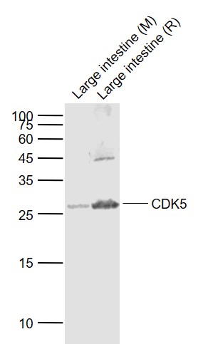 Lane 1: Mouse Large intestine lysates; Lane 2: Rat Large intestine lysates probed with CDK5 Polyclonal Antibody, Unconjugated (bs-0559R) at 1:1000 dilution and 4˚C overnight incubation. Followed by conjugated secondary antibody incubation at 1:20000 for 60 min at 37˚C.