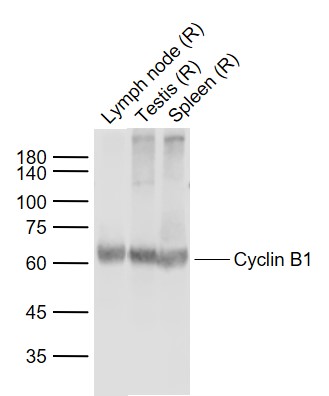 Lane 1: Rat Lymph node lysates; Lane 2: Rat Testis lysates; Lane 3: Rat Spleen lysates probed with Cyclin B1 Polyclonal  Antibody, Unconjugated (bs-0572R) at 1:1000 dilution and 4˚C overnight incubation. Followed by conjugated secondary antibody incubation at 1:20000 for 60 min at 37˚C.