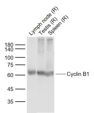 Lane 1: Rat Lymph node lysates; Lane 2: Rat Testis lysates; Lane 3: Rat Spleen lysates probed with Cyclin B1 Polyclonal Antibody, Unconjugated (bs-0572R) at 1:1000 dilution and 4˚C overnight incubation. Followed by conjugated secondary antibody incubation at 1:20000 for 60 min at 37˚C.