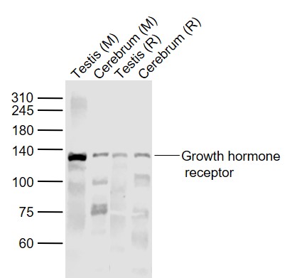 Lane 1: Mouse Testis lysates; Lane 2: Mouse Cerebrum lysates; Lane 3: Rat Testis lysates; Lane 4: Rat Cerebrum lysates probed with GHR Polyclonal Antibody, Unconjugated (bs-0654R) at 1:1000 dilution and 4˚C overnight incubation. Followed by conjugated secondary antibody incubation at 1:20000 for 60 min at 37˚C.