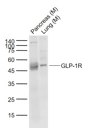 Lane 1: Mouse Pancreas lysates; Lane 2: Mouse Lung lysates probed with GLP-1R Polyclonal Antibody, Unconjugated (bs-1559R) at 1:1000 dilution and 4˚C overnight incubation. Followed by conjugated secondary antibody incubation at 1:20000 for 60 min at 37˚C.
