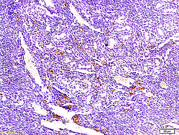 Formalin-fixed and paraffin embedded mouse endometrium tissue labeled with Anti-ECM1 Polyclonal Antibody, Unconjugated (bs-0776R) at 1:300, followed by conjugation to the secondary antibody and DAB staining