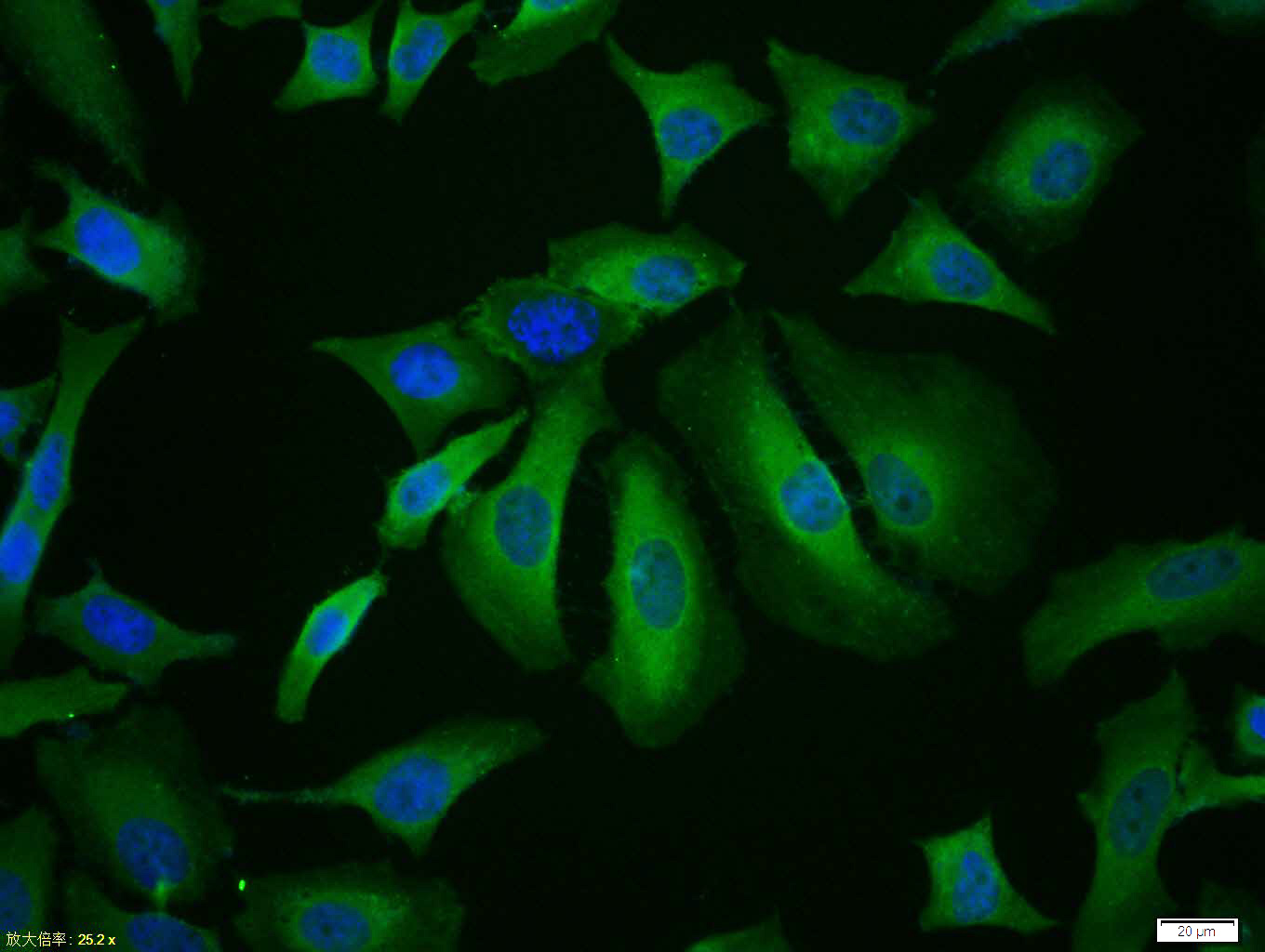 Tissue/cell:Hela cell; 4% Paraformaldehyde-fixed; Triton X-100 at room temperature for 20 min; Blocking buffer (normal goat serum,C-0005) at 37°C for 20 min; Antibody incubation with (CDK4) polyclonal Antibody, Unconjugated (bs-0633R) 1:100, 90 minutes at 37°C; followed by a FITC conjugated Goat Anti-Rabbit IgG antibody at 37°C for 90 minutes, DAPI (blue, C02-04002) was used to stain the cell nuclei.