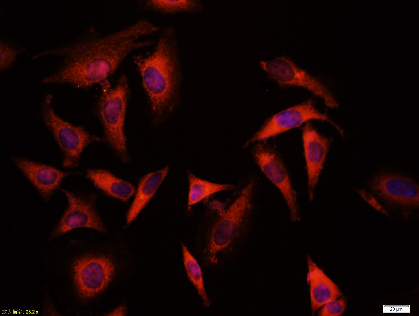 Tissue/cell:Hela cell; 4% Paraformaldehyde-fixed; Triton X-100 at room temperature for 20 min; Blocking buffer (normal goat serum,C-0005) at 37°C for 20 min; Antibody incubation with (CD44v3) polyclonal Antibody, Unconjugated (bs-4497R) 1:100, 90 minutes at 37°C; followed by a CY3 conjugated Goat Anti-Rabbit IgG antibody at 37°C for 90 minutes, DAPI (blue, C02-04002) was used to stain the cell nuclei.