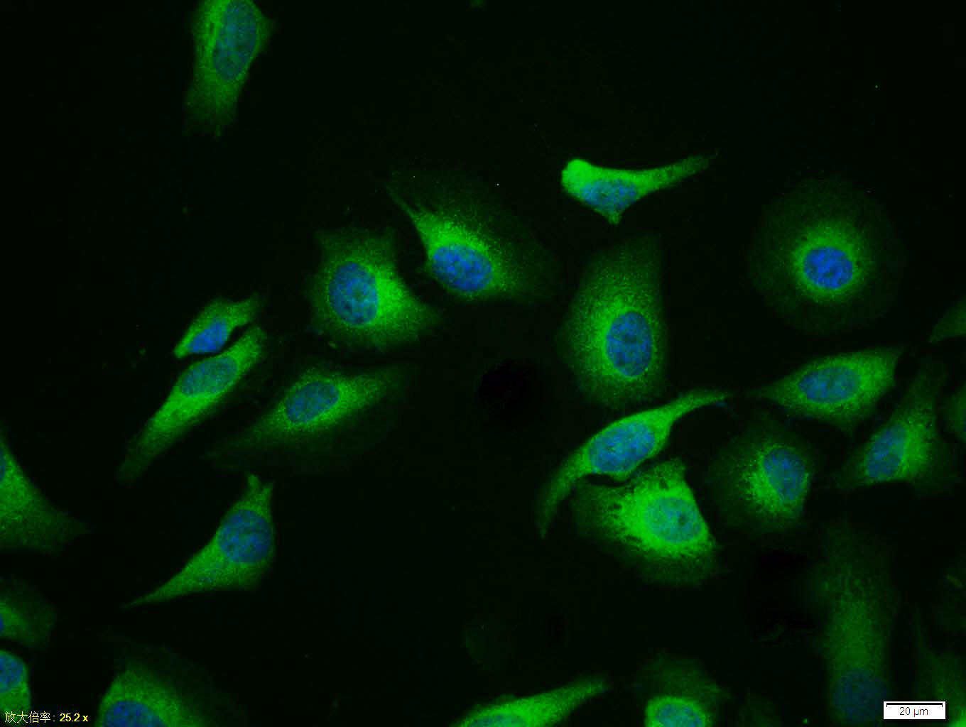 Tissue/cell:Hela cell; 4% Paraformaldehyde-fixed; Triton X-100 at room temperature for 20 min; Blocking buffer (normal goat serum,C-0005) at 37°C for 20 min; Antibody incubation with (CD44v3) polyclonal Antibody, Unconjugated (bs-4497R) 1:100, 90 minutes at 37°C; followed by a FITC conjugated Goat Anti-Rabbit IgG antibody at 37°C for 90 minutes, DAPI (blue, C02-04002) was used to stain the cell nuclei.