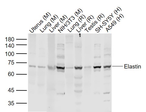 Lane 1: Mouse Uterus lysates; Lane 2: Mouse Lung lysates; Lane 3: Mouse Liver lysates; Lane 4: Mouse NIH/3T3 cell lysates; Lane 5: Rat Lung cell lysates; Lane 6: Rat Liver lysates; Lane 7: Rat Testis lysates; Lane 8: Human SH-SY5Y cell lysates; Lane 9: Human A549 cell lysates probed with Elastin Polyclonal Antibody, Unconjugated (bs-1756R) at 1:1000 dilution and 4˚C overnight incubation. Followed by conjugated secondary antibody incubation at 1:20000 for 60 min at 37˚C.