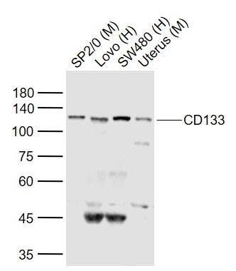 Lane 1: Mouse Sp2/0 cell lysates; Lane 2: Human LOVO cell lysates; Lane 3: Human SW480 cell lysates; Lane 4: Mouse Uterus cell lysates probed with CD133 Polyclonal Antibody, Unconjugated (bs-4770R) at 1:1000 dilution and 4˚C overnight incubation. Followed by conjugated secondary antibody incubation at 1:20000 for 60 min at 37˚C. Lane 1: Mouse Sp2/0 cell lysates; Lane 2: Human LOVO cell lysates; Lane 3: Human SW480 cell lysates; Lane 4: Mouse Uterus cell lysates probed with CD133 Polyclonal Antibody, Unconjugated (bs-4770R) at 1:1000 dilution and 4˚C overnight incubation. Followed by conjugated secondary antibody incubation at 1:20000 for 60 min at 37˚C.