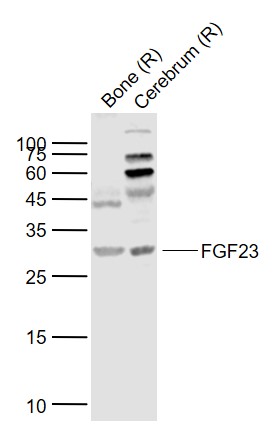 Lane 1: Rat Bone lysates; Lane 2: Rat Cerebrum lysates probed with FGF23 Polyclonal Antibody, Unconjugated (bs-5768R) at 1:1000 dilution and 4˚C overnight incubation. Followed by conjugated secondary antibody incubation at 1:20000 for 60 min at 37˚C.
