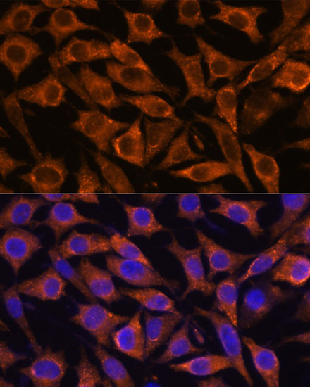 L929 cell; 4% Paraformaldehyde-fixed; Triton X-100 at room temperature for 20 min; Blocking buffer (normal goat serum, C-0005) at 37°C for 20 min; Antibody incubation with (IFITM3 ) polyclonal Antibody, Unconjugated (bs-55108R) 1:100, 90 minutes at 37°C; followed by a conjugated Goat Anti-Rabbit IgG antibody at 37°C for 90 minutes, DAPI (blue, C02-04002) was used to stain the cell nuclei.