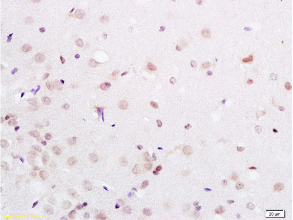 Formalin-fixed and paraffin embedded rat brain labeled with Anti-PAX3 Polyclonal Antibody, Unconjugated(bs-1097R) at 1:200 followed by conjugation to the secondary antibody and DAB staining