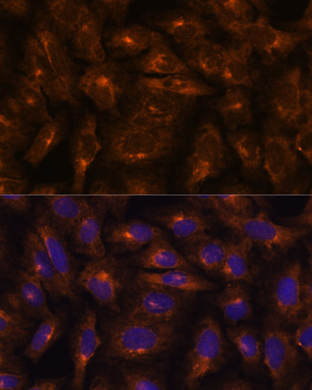 U2-OScell; 4% Paraformaldehyde-fixed; Triton X-100 at room temperature for 20 min; Blocking buffer (normal goat serum, C-0005) at 37°C for 20 min; Antibody incubation with (IFITM3 ) polyclonal Antibody, Unconjugated (bs-55108R) 1:100, 90 minutes at 37°C; followed by a conjugated Goat Anti-Rabbit IgG antibody at 37°C for 90 minutes, DAPI (blue, C02-04002) was used to stain the cell nuclei.
