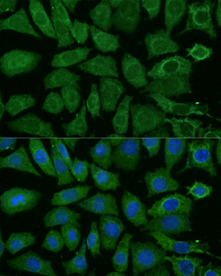 L929 cell; 4% Paraformaldehyde-fixed; Triton X-100 at room temperature for 20 min; Blocking buffer (normal goat serum, C-0005) at 37°C for 20 min; Antibody incubation with (NDUFB4) polyclonal Antibody, Unconjugated (bs-55145R) 1:100, 90 minutes at 37°C; followed by a conjugated Goat Anti-Rabbit IgG antibody at 37°C for 90 minutes, DAPI (blue, C02-04002) was used to stain the cell nuclei.
