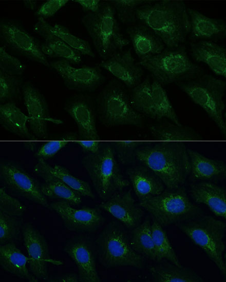 U2-OS cell; 4% Paraformaldehyde-fixed; Triton X-100 at room temperature for 20 min; Blocking buffer (normal goat serum, C-0005) at 37°C for 20 min; Antibody incubation with (NDUFB4) polyclonal Antibody, Unconjugated (bs-55145R) 1:100, 90 minutes at 37°C; followed by a conjugated Goat Anti-Rabbit IgG antibody at 37°C for 90 minutes, DAPI (blue, C02-04002) was used to stain the cell nuclei.
