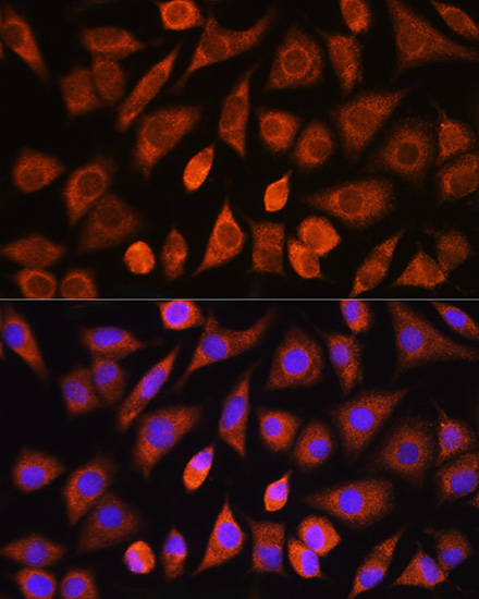 L929 cell; 4% Paraformaldehyde-fixed; Triton X-100 at room temperature for 20 min; Blocking buffer (normal goat serum, C-0005) at 37°C for 20 min; Antibody incubation with (EGLN1) polyclonal Antibody, Unconjugated (bs-55063R) 1:100, 90 minutes at 37°C; followed by a conjugated Goat Anti-Rabbit IgG antibody at 37°C for 90 minutes, DAPI (blue, C02-04002) was used to stain the cell nuclei.