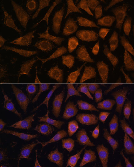 L929 cell; 4% Paraformaldehyde-fixed; Triton X-100 at room temperature for 20 min; Blocking buffer (normal goat serum, C-0005) at 37°C for 20 min; Antibody incubation with (MAPK6) polyclonal Antibody, Unconjugated (bs-55129R) 1:100, 90 minutes at 37°C; followed by a conjugated Goat Anti-Rabbit IgG antibody at 37°C for 90 minutes, DAPI (blue, C02-04002) was used to stain the cell nuclei.