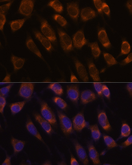L929 cell; 4% Paraformaldehyde-fixed; Triton X-100 at room temperature for 20 min; Blocking buffer (normal goat serum, C-0005) at 37°C for 20 min; Antibody incubation with (SEC61B) polyclonal Antibody, Unconjugated (bs-55194R) 1:100, 90 minutes at 37°C; followed by a conjugated Goat Anti-Rabbit IgG antibody at 37°C for 90 minutes, DAPI (blue, C02-04002) was used to stain the cell nuclei.