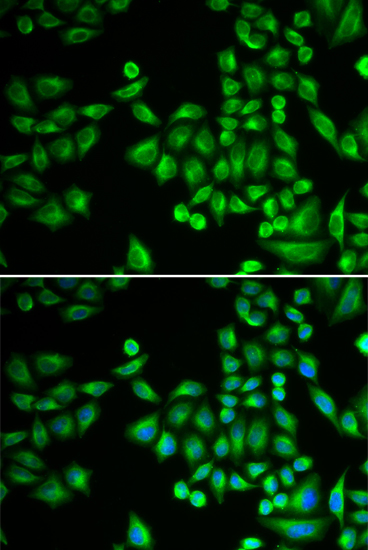 MCF7 cell; 4% Paraformaldehyde-fixed; Triton X-100 at room temperature for 20 min; Blocking buffer (normal goat serum, C-0005) at 37\u00b0C for 20 min; Antibody incubation with (PTPN1 ) polyclonal Antibody, Unconjugated (bs-55182R) 1:100, 90 minutes at 37\u00b0C; followed by a conjugated Goat Anti-Rabbit IgG antibody at 37\u00b0C for 90 minutes, DAPI (blue, C02-04002) was used to stain the cell nuclei.