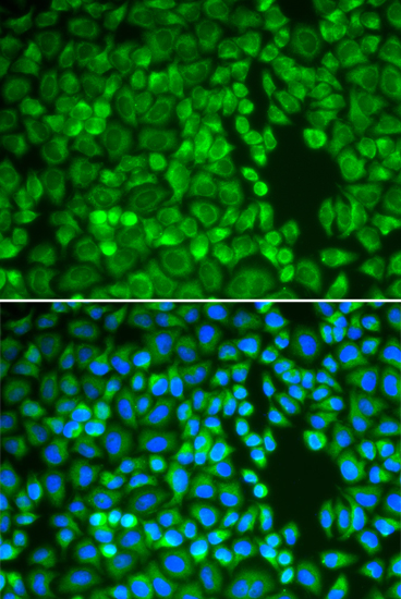 A549 cell; 4% Paraformaldehyde-fixed; Triton X-100 at room temperature for 20 min; Blocking buffer (normal goat serum, C-0005) at 37°C for 20 min; Antibody incubation with (IDE) polyclonal Antibody, Unconjugated (bs-55107R) 1:100, 90 minutes at 37°C; followed by a conjugated Goat Anti-Rabbit IgG antibody at 37°C for 90 minutes, DAPI (blue, C02-04002) was used to stain the cell nuclei.