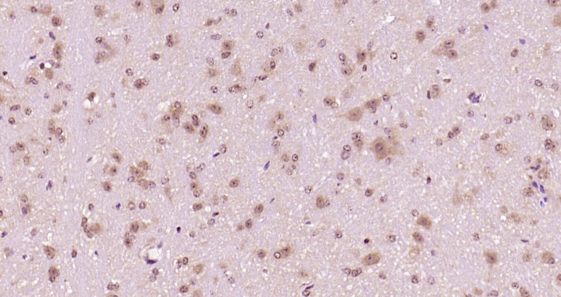 Paraformaldehyde-fixed, paraffin embedded Mouse brain; Antigen retrieval by boiling in sodium citrate buffer (pH6.0) for 15min; Block endogenous peroxidase by 3% hydrogen peroxide for 20 minutes; Blocking buffer (normal goat serum) at 37°C for 30min; Antibody incubation with phospho-Alpha synuclein(Ser129) Monoclonal Antibody, Unconjugated (bsm-41203M) at 1:2000 overnight at 4°C, DAB staining.
