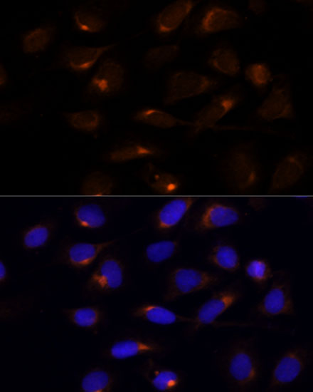 U2-OS cell; 4% Paraformaldehyde-fixed; Triton X-100 at room temperature for 20 min; Blocking buffer (normal goat serum, C-0005) at 37\u00b0C for 20 min; Antibody incubation with (SCD) polyclonal Antibody, Unconjugated (bs-55193R) 1:100, 90 minutes at 37\u00b0C; followed by a conjugated Goat Anti-Rabbit IgG antibody at 37\u00b0C for 90 minutes, DAPI (blue, C02-04002) was used to stain the cell nuclei.